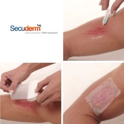 SURPANSEMENT ETANCHE SECUDERM 10x10CM